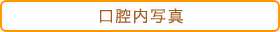 口腔内写真