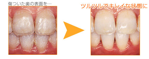 トリートメントサプリの効果
